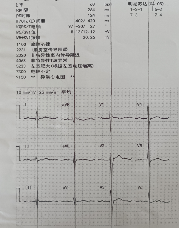 全市首例！ICD聯(lián)合CCM一站式植入術(shù)，雙起搏器為患者救命又護(hù)心!